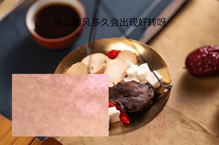 https://www.bdfsjzyy.com/d/file/p/e5e92082928415a4dcd68b3c0368277e.jpeg