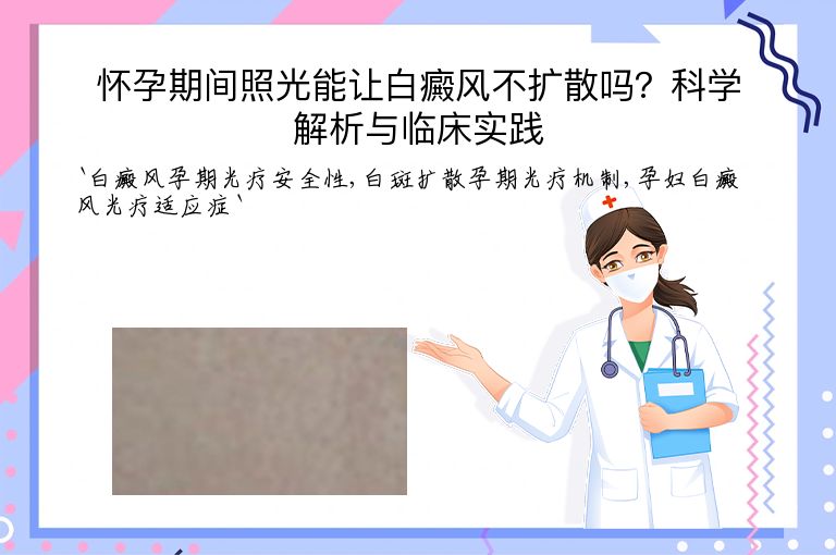 怀孕期间照光能让白癜风不扩散吗？科学解析与临床实践”