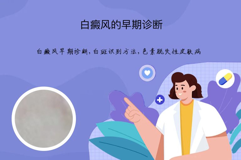 白癜风的早期诊断”