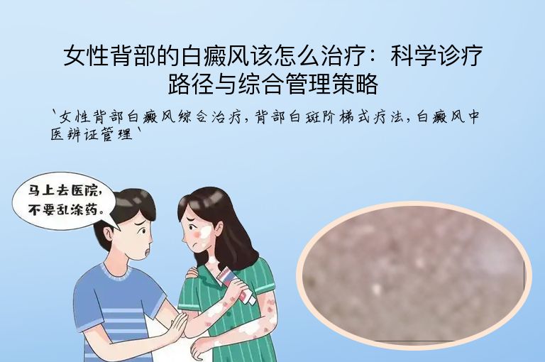女性背部的白癜风该怎么治疗：科学诊疗路径与综合管理策略