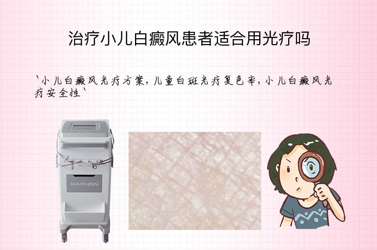治疗小儿白癜风患者适合用光疗吗