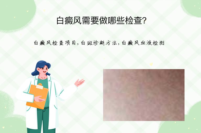 白癜风需要做哪些检查？”