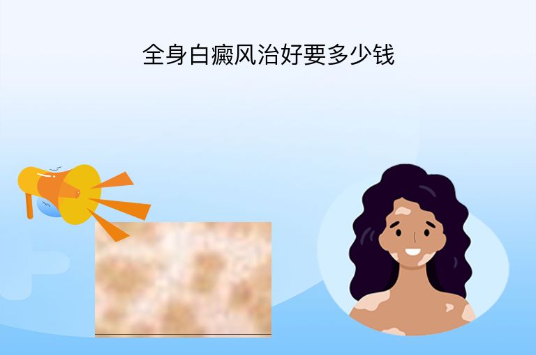全身白癜风治好要多少钱”