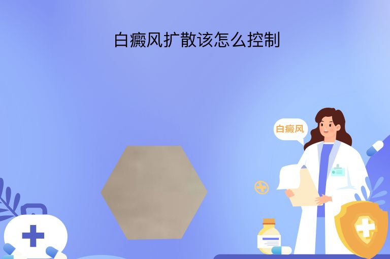 白癜风扩散该怎么控制”