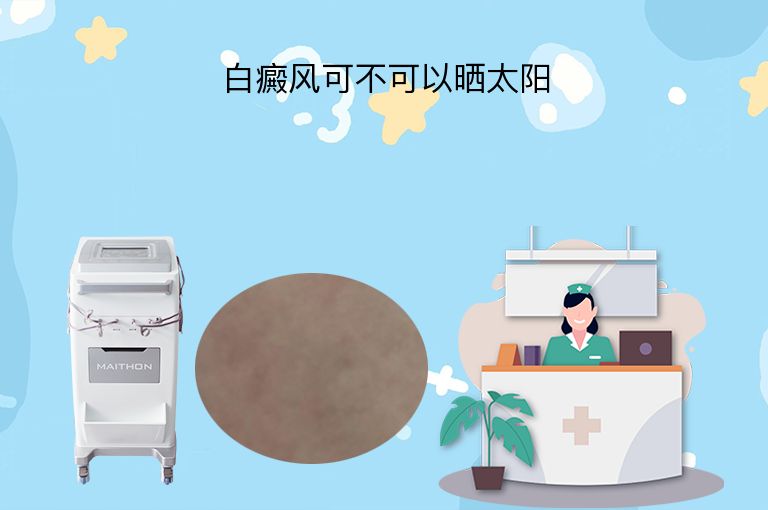 白癜风可不可以晒太阳”