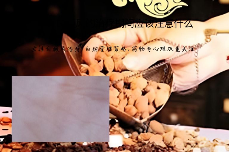 女性白癜风的治疗期间应该注意什么”