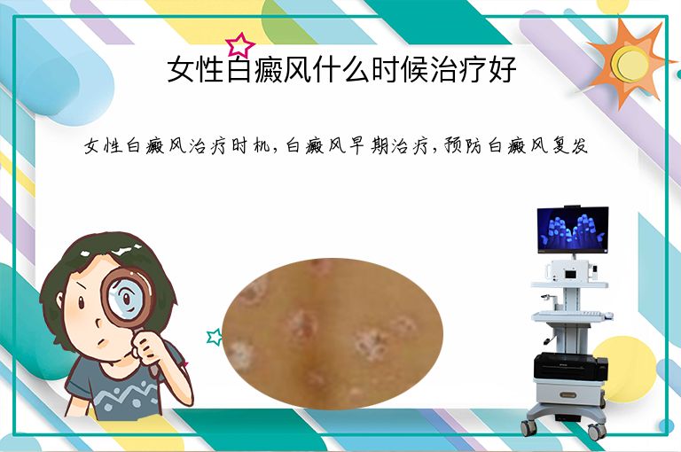 女性白癜风什么时候治疗好”