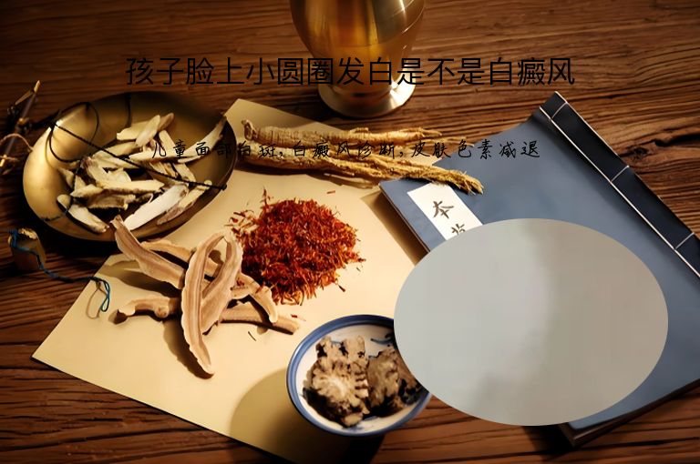 孩子脸上小圆圈发白是不是白癜风”