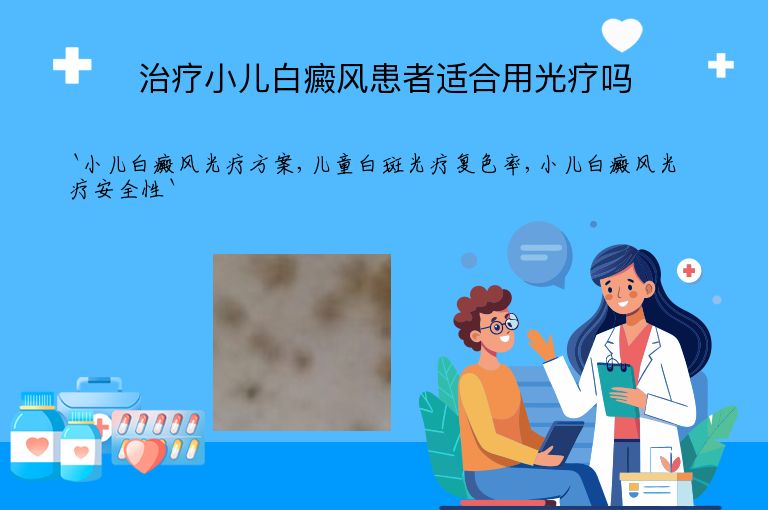 治疗小儿白癜风患者适合用光疗吗