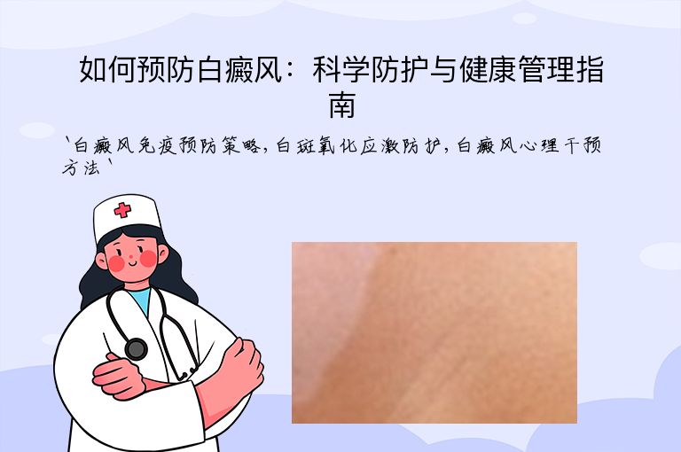 如何预防白癜风:科学防护与健康管理指南