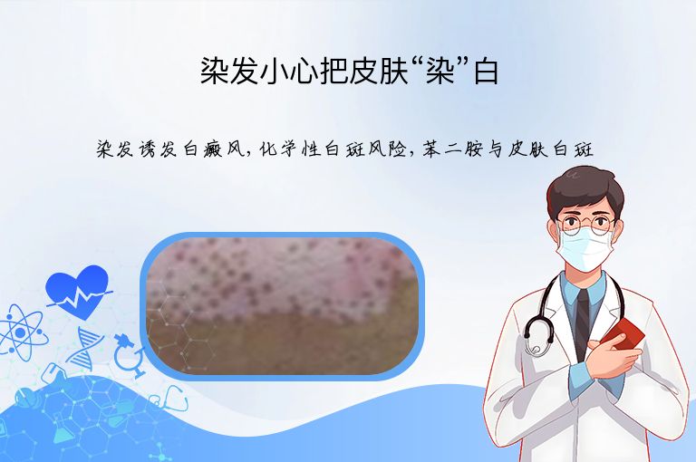 染发小心把皮肤“染”白”