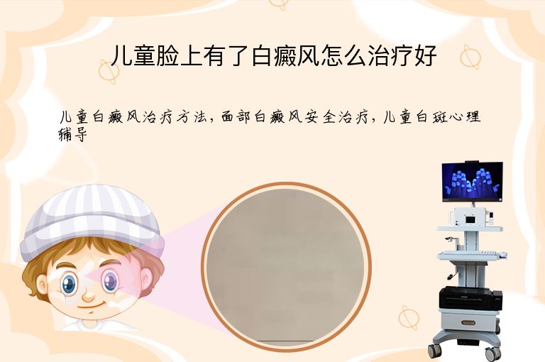 儿童脸上有了白癜风怎么治疗好”