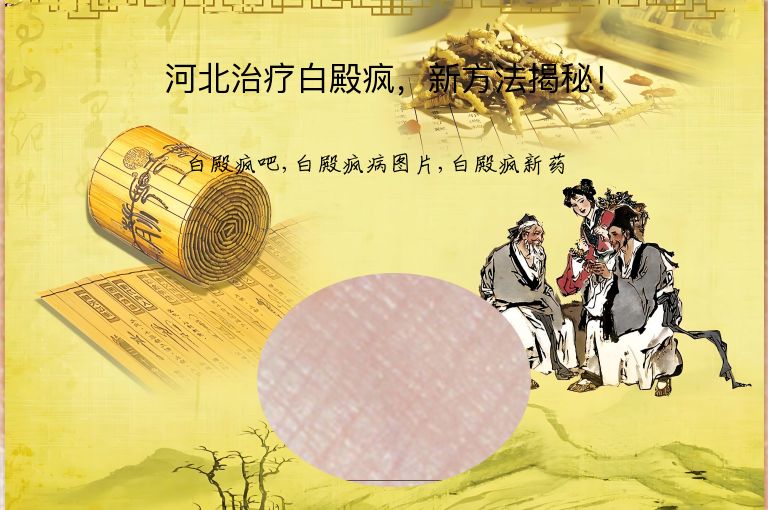 河北治疗白殿疯，新方法揭秘！”