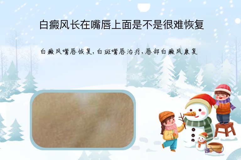 白癜风长在嘴唇上面是不是很难恢复”