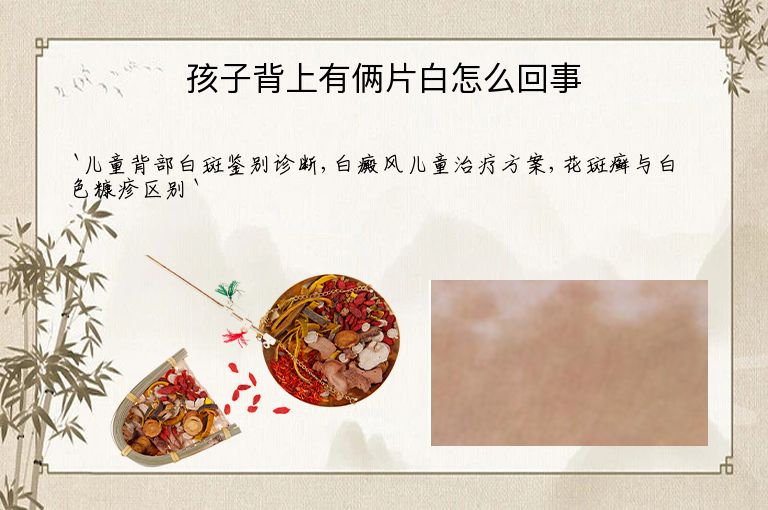 孩子背上有俩片白怎么回事