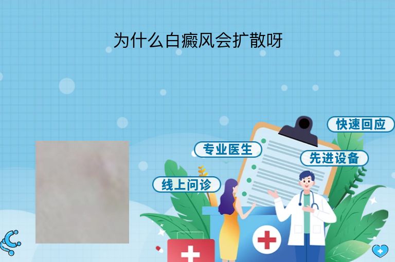 https://www.bdfsjzyy.com/d/file/p/1d33d442862513da5cb5cfa871063508.jpeg