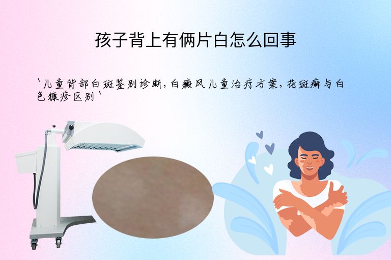 孩子背上有俩片白怎么回事