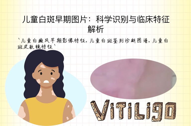 儿童白斑早期图片:科学识别与临床特征解析