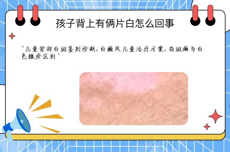 孩子背上有俩片白怎么回事