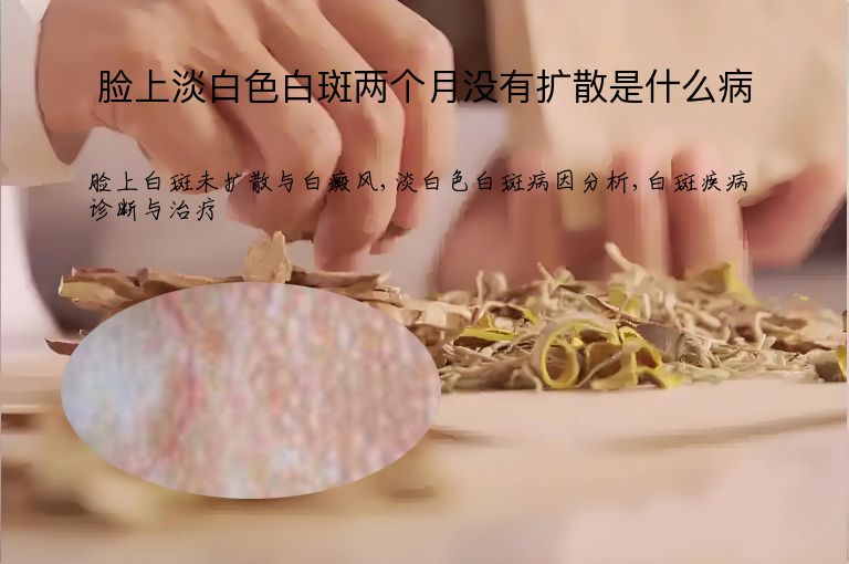 脸上淡白色白斑两个月没有扩散是什么病”