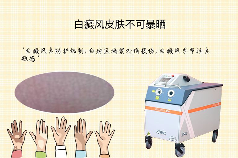 白癜风皮肤不可暴晒