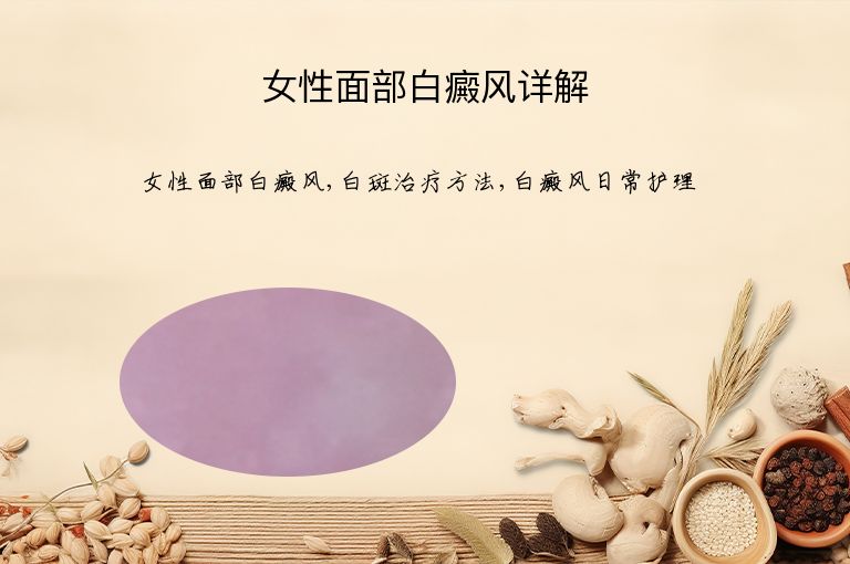 女性面部白癜风详解”