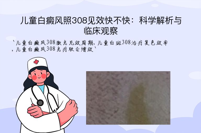 儿童白癜风照308见效快不快：科学解析与临床观察