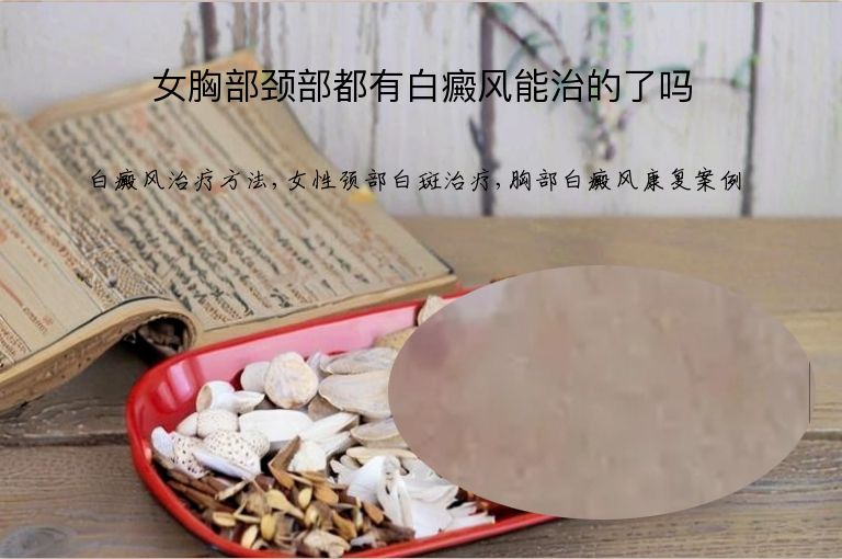 女胸部颈部都有白癜风能治的了吗”