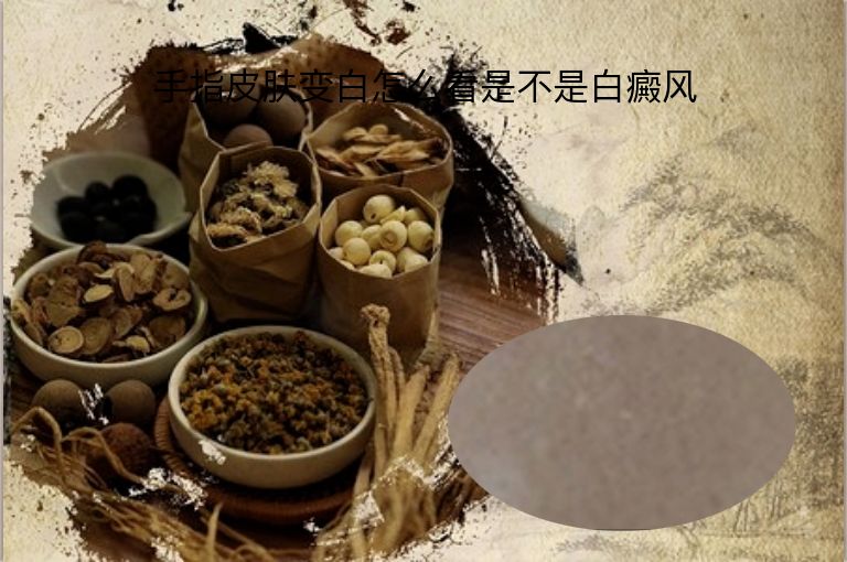 https://www.bdfsjzyy.com/d/file/p/c641b53b018af050dff517b08b406d39.jpeg