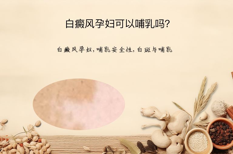 白癜风孕妇可以哺乳吗?”