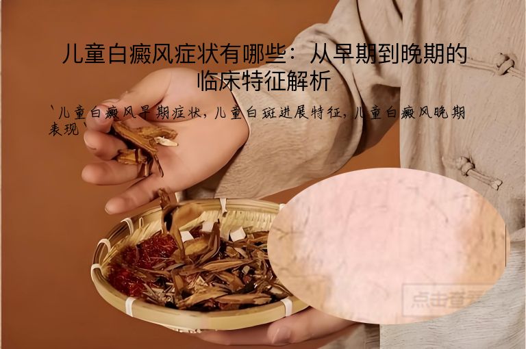儿童白癜风症状有哪些：从早期到晚期的临床特征解析