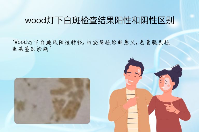 wood灯下白斑检查结果阳性和阴性区别”