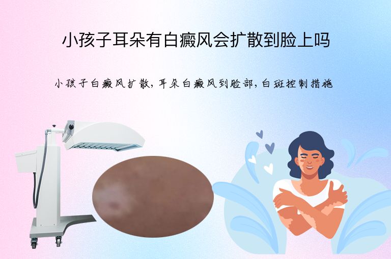 https://www.bdfsjzyy.com/d/file/p/8f07035ca459f75ec474e572b9555775.jpeg