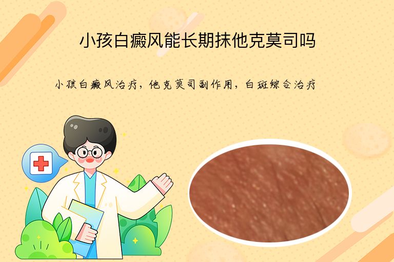 小孩白癜风能长期抹他克莫司吗”
