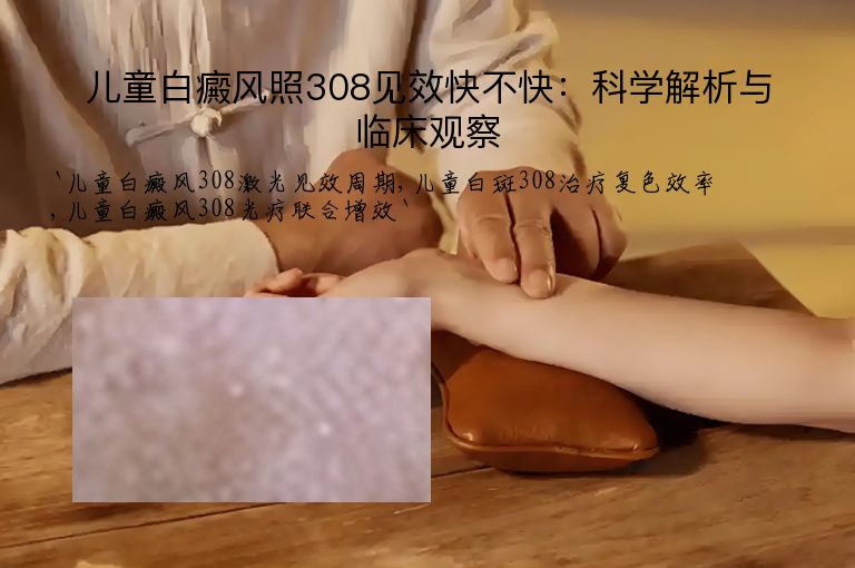 儿童白癜风照308见效快不快：科学解析与临床观察