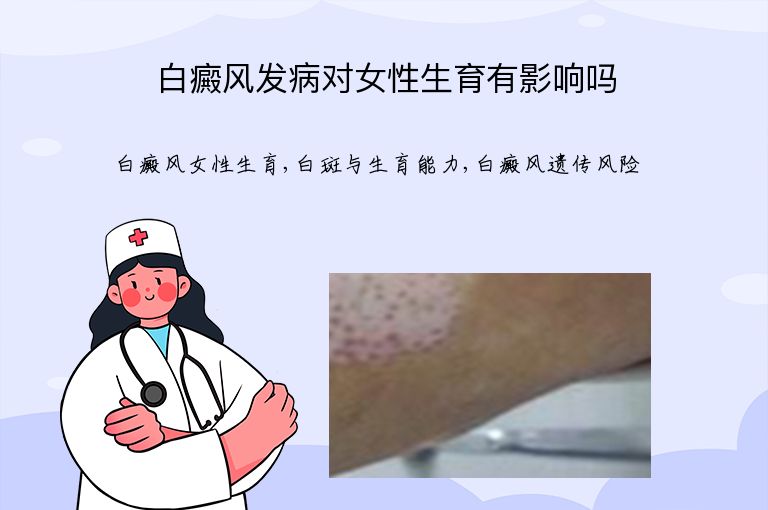 白癜风发病对女性生育有影响吗”