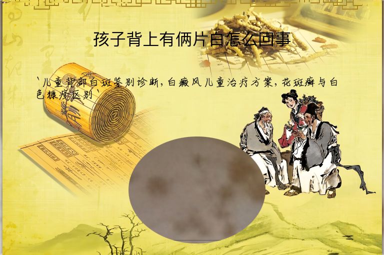 孩子背上有俩片白怎么回事