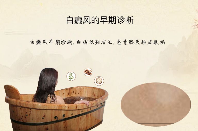 白癜风的早期诊断”