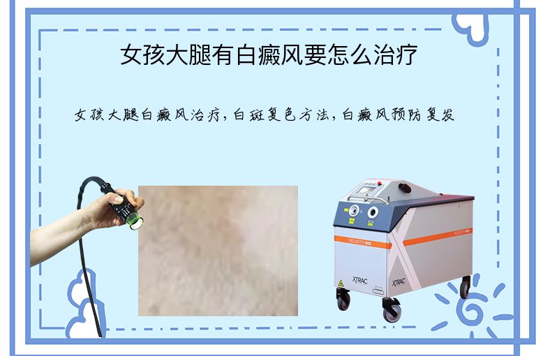 女孩大腿有白癜风要怎么治疗”