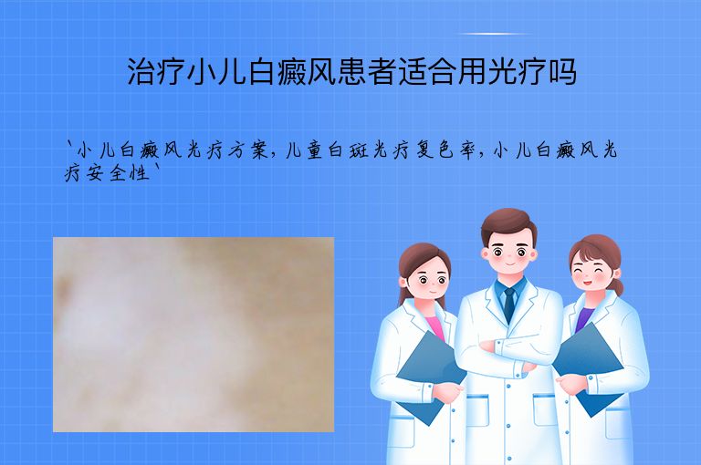 治疗小儿白癜风患者适合用光疗吗
