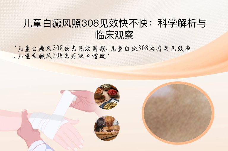儿童白癜风照308见效快不快:科学解析与临床观察