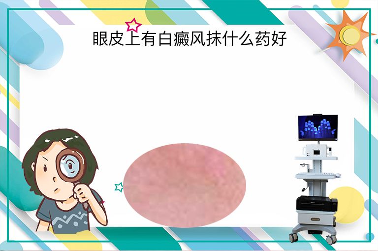 眼皮上有白癜风抹什么药好”