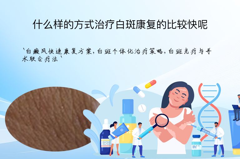什么样的方式治疗白斑康复的比较快呢