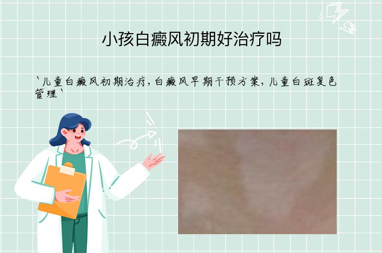 小孩白癜风初期好治疗吗