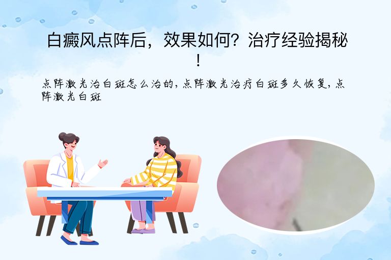 白癜风点阵后，效果如何？治疗经验揭秘！”