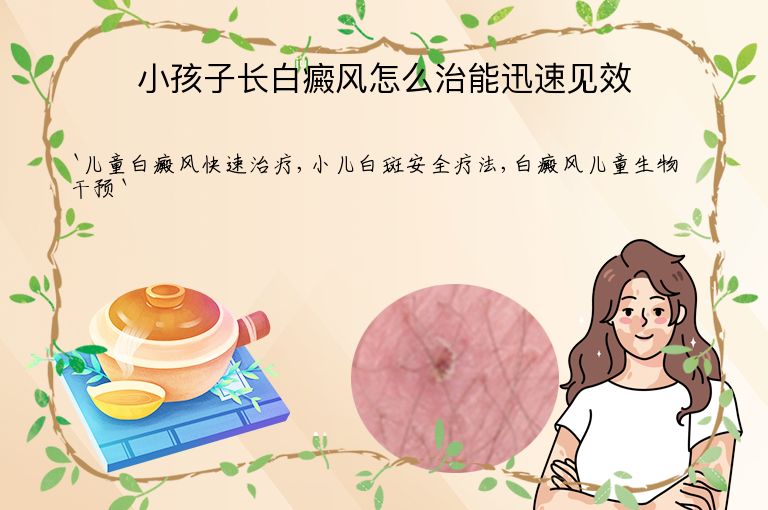 小孩子长白癜风怎么治能迅速见效”