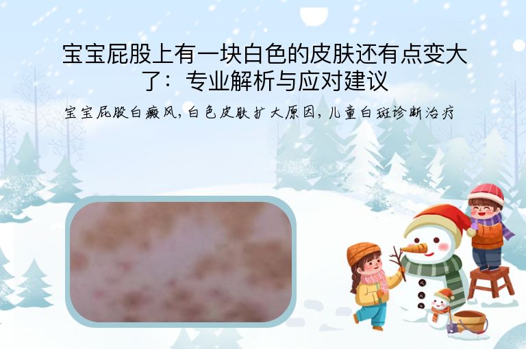 宝宝屁股上有一块白色的皮肤还有点变大了：专业解析与应对建议”