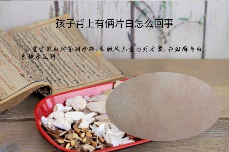 孩子背上有俩片白怎么回事