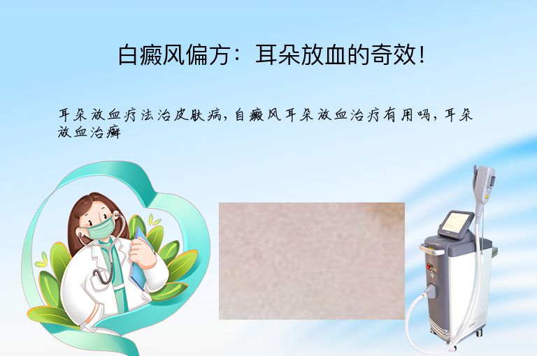 白癜风偏方:耳朵放血的奇效!”