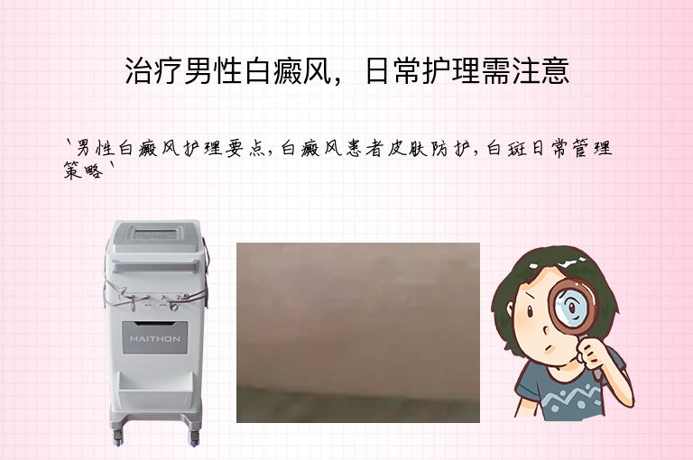 治疗男性白癜风,日常护理需注意